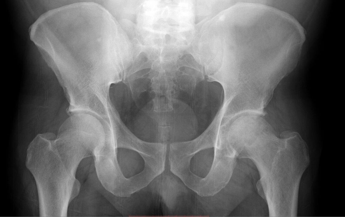 hip joint diagnostics