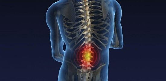 Back pain with osteochondrosis of the lumbar spine