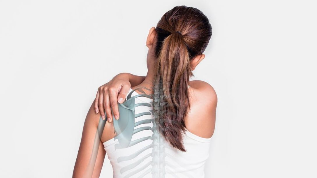 Pain due to osteoarthritis of the shoulder joint