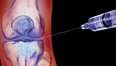 Methods for treating joint arthrosis
