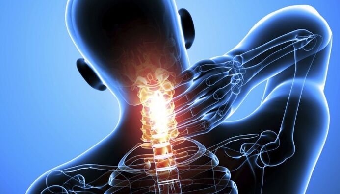 Pain in the cervical spine